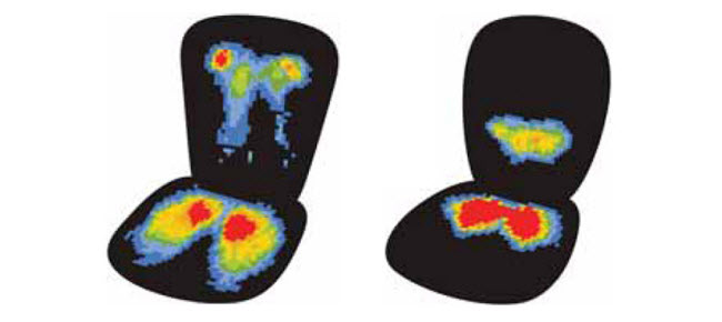 ارزیابی فعالیت الکتریکی عضلات هنگام اسنفاده از صندلی 